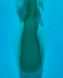 Light Cyan with Peacock Transparent Drizzle Special Edition (2002PLC) 3mm